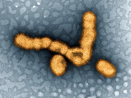 H1N1 influensavirus